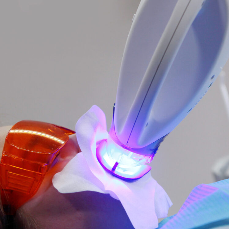 冷光美白