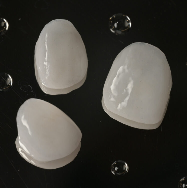 陶瓷貼片